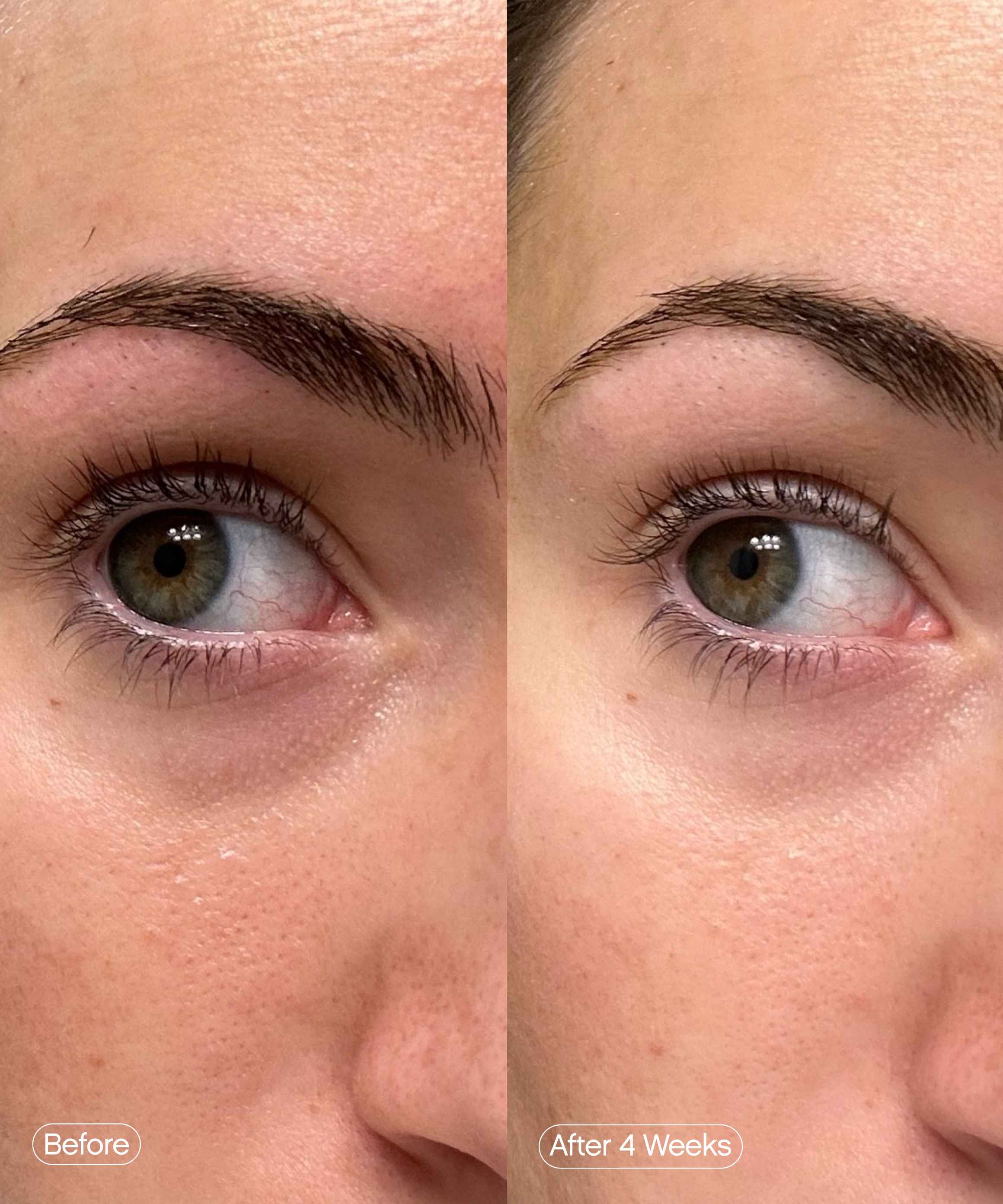 brightening eye mask