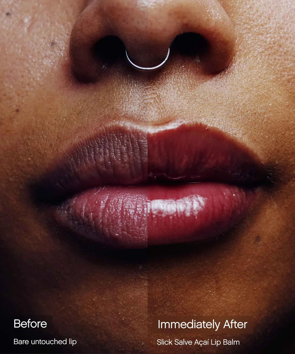 Split before-and-after of lips, dry on the left and visibly plump and shiny on the right, after applying Topicals Slick Salve Açaí lip balm.
