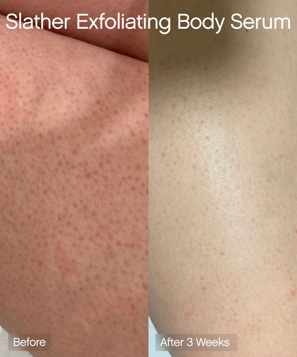 Exfoliating Body Duo