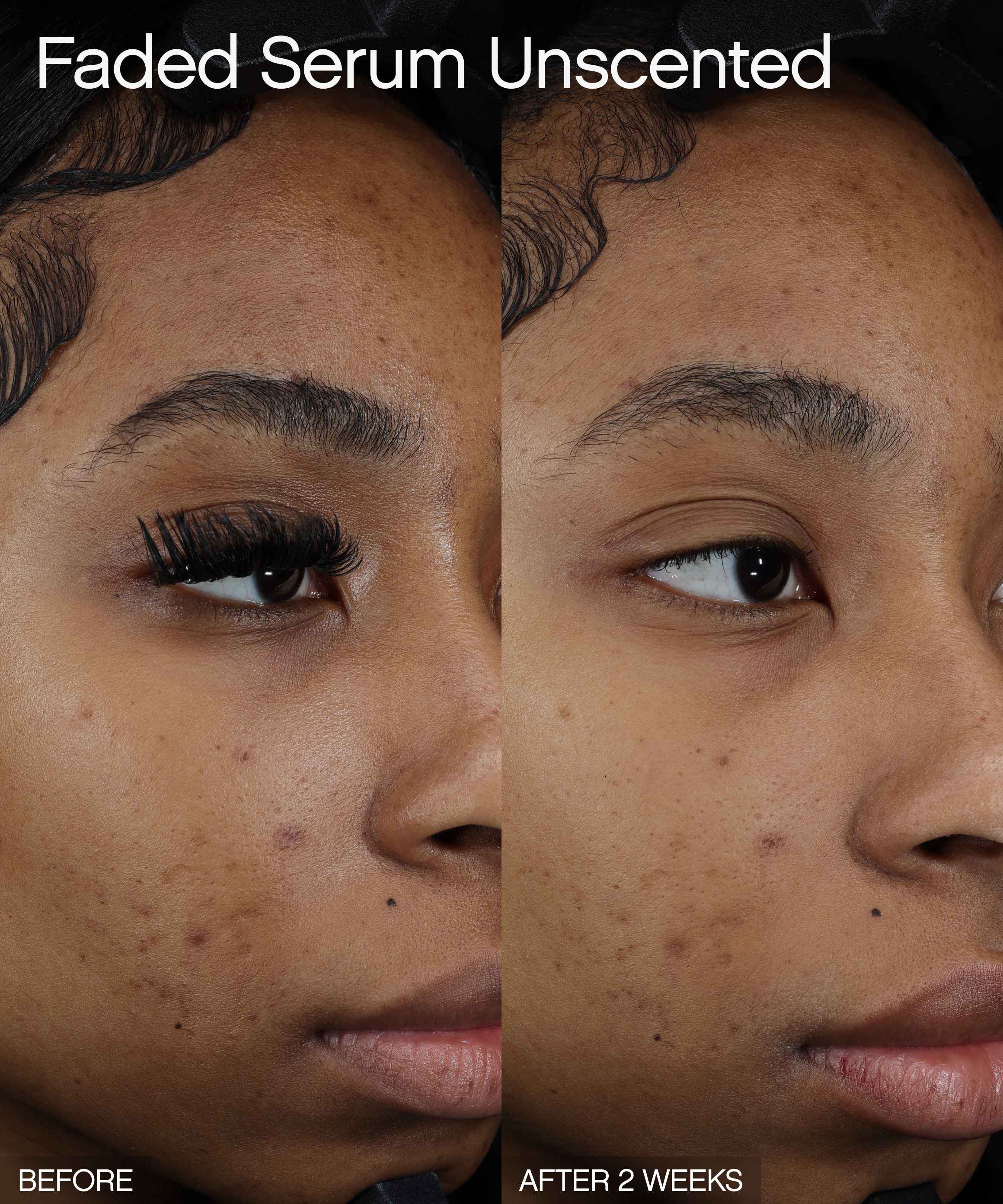 Discoloration Duo