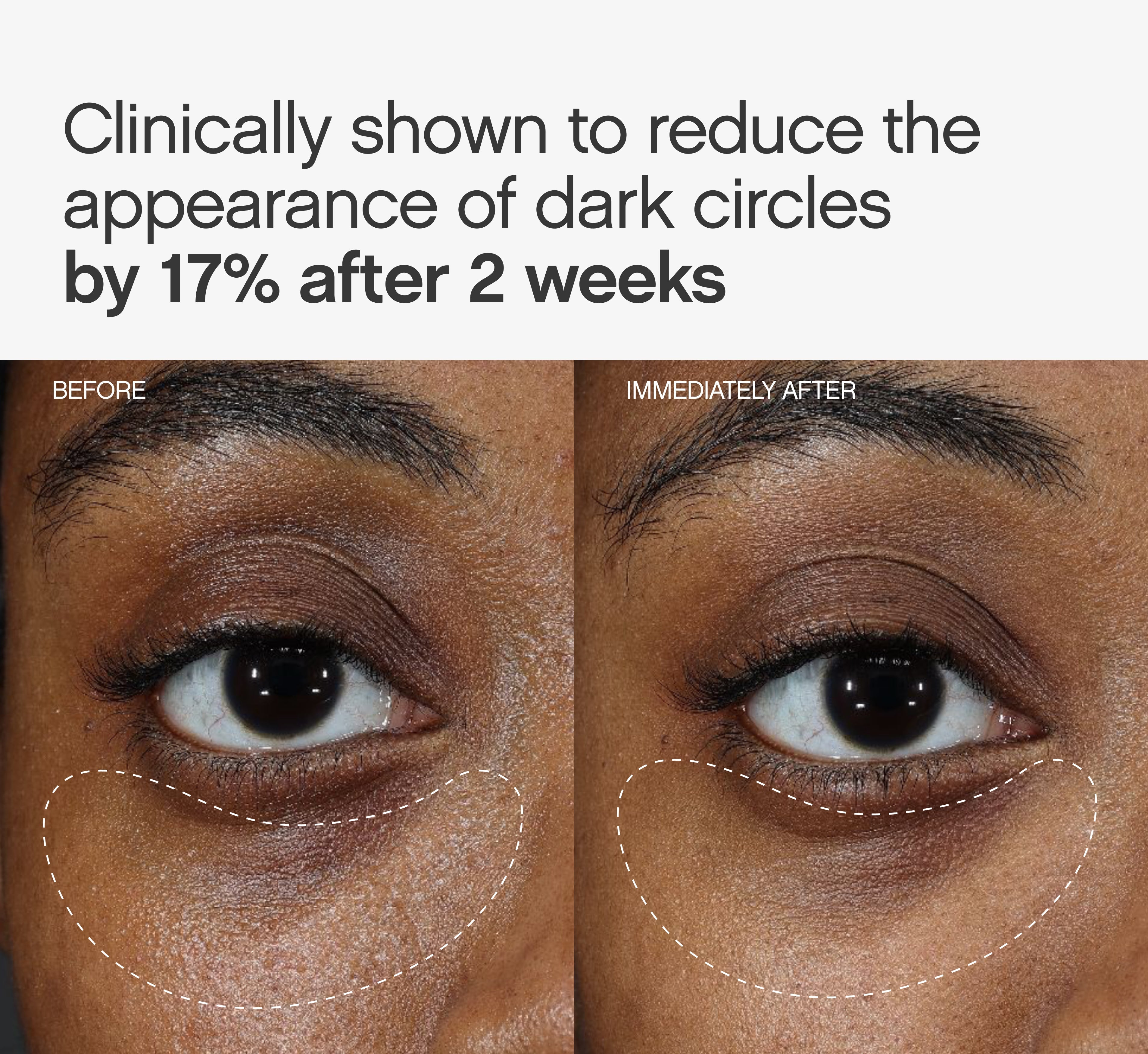 Faded Under Eye Masks