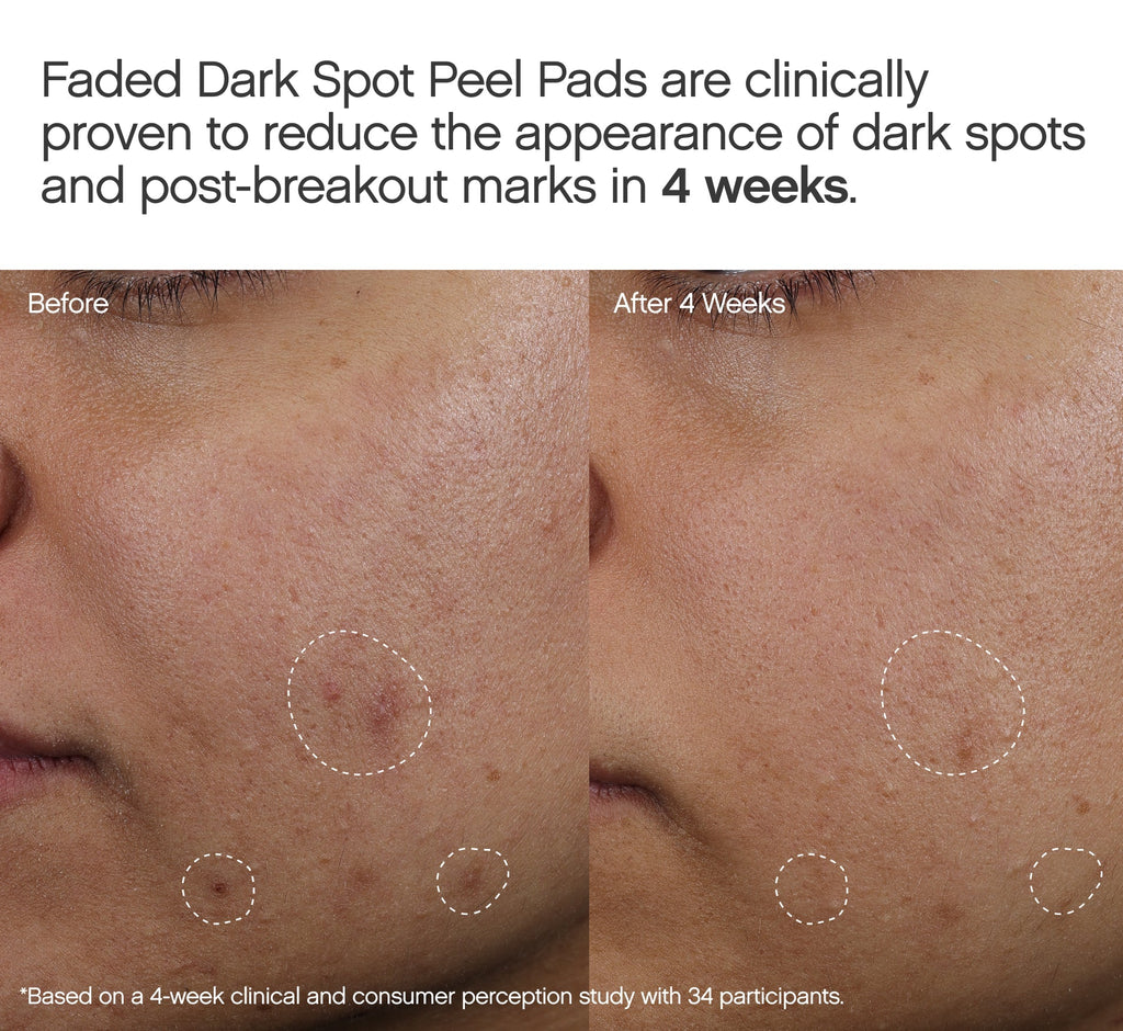 Faded Dark Spot Peel Pads