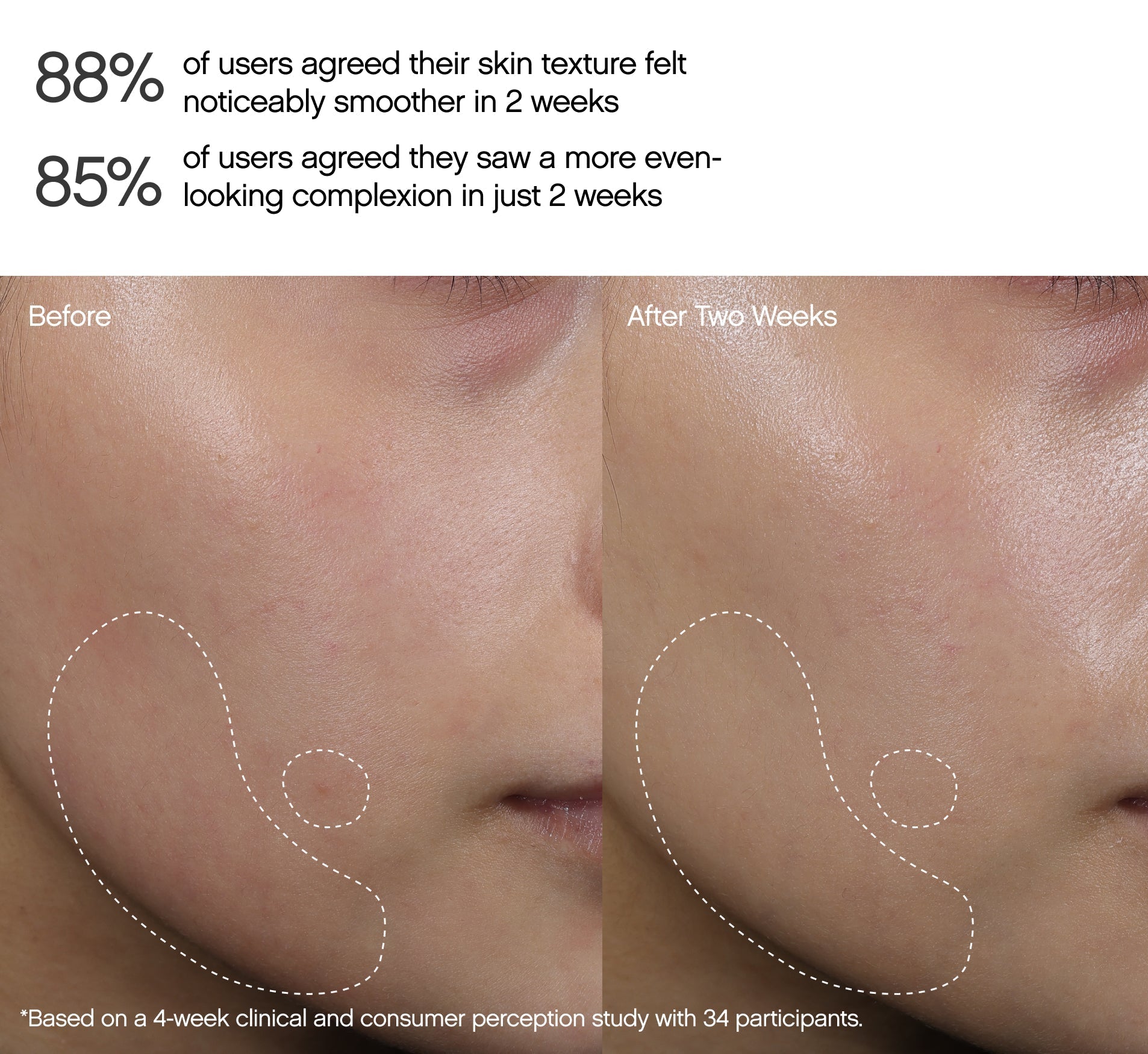 Faded Dark Spot Peel Pads